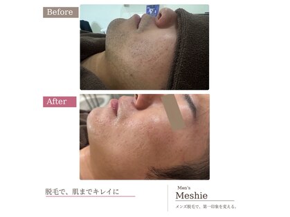 メンズミーシェ(Men's Meshie)の写真