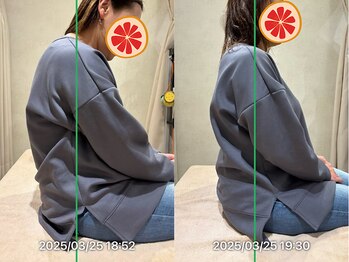 グレフル鍼灸接骨院 整体院 心斎橋/