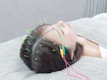 ハリカ 東京新宿店(HARIKA)/頭からリフトアップしたい方に