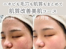 アルカンシエル(arcenciel)の雰囲気（ニキビも毛穴も肌質も根本改善。つるんと透明感のある素肌へ。）