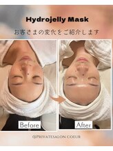 コア(Coeur)/befor→after