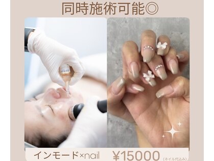 リズ(rE:S)の写真