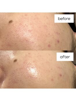 エリュレ(Elyure)/セラピール