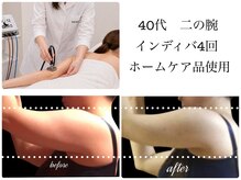 エルール トータルビューティ(Aileure total beauty)