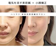 ハリサク