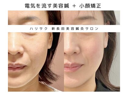 ハリサクの写真