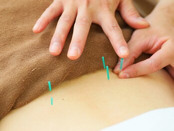 そら鍼灸接骨マッサージ院 ジョイフル本田千葉ニュータウン店/自律神経を整える、はり施術