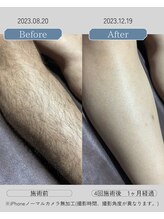 ジールクス 太田店(G LUX)/足(ひざ下)