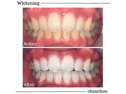 シュシュ(chouchou)の写真
