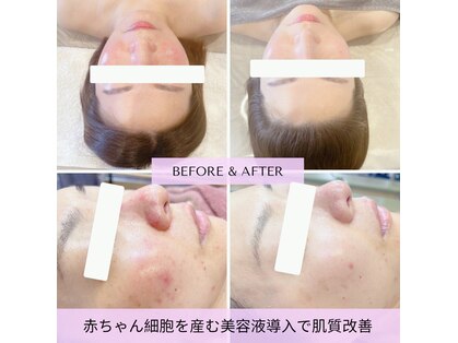 マルカ(MARUKA)の写真