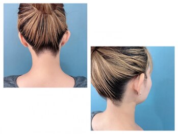 ミライ 福津店(mirai)の写真/春のお手入れはmiraiにお任せ♪光フェイシャルで肌力アップも◎つるスベお肌の光脱毛もオススメ！！