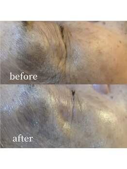 スワロ(suwaro)/年齢ぐすみ炭酸でリセット♪