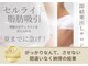 強力痩身専門店　西麻布【La.SALON HOPE】の写真/【感動の美脚】速攻セル脂肪撃退♪頑固でボコボコセルをつぶして、キュッと引き締まった魅せる美脚へ!