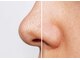 メイ(Mey)の写真/毛穴ケア14種類のハーブ酵素とラジオ波が導く、なめらかな素肌体験へ☆
