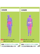 ニコラ(NICORA)/AI診断（姿勢分析）3