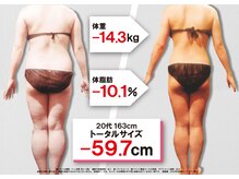 セントラヴィ 本厚木店/Before After【20代女性(1)】