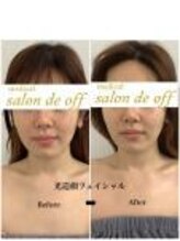メディカルサロンドオフ 堺東店(medical salon de off)/光造顔フェイシャル★ &nbsp;施術前後