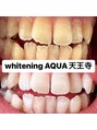 アクア 天王寺店(AQUA)&nbsp;セルフホワイトニング/大阪/天王寺/小顔/ホワイトニング/美白