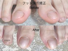 ヴェルニ(VERNI)の雰囲気（手足の深爪をバレない自爪風ネイルに！デザインやカラーも可能◎）