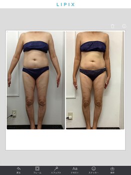 健康痩身研究所 名和店/ビフォーアフター