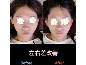 美容矯正サロン レレポノ(LELEPONO)/左右差改善