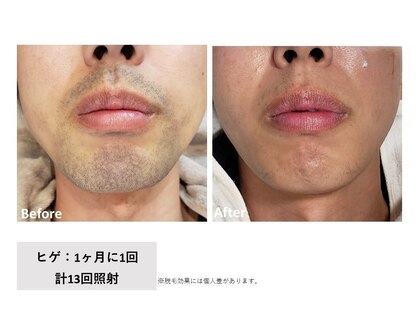 サンデイ(Sunday)の写真