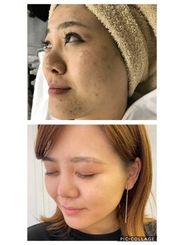 アルマサロン 菊陽(Almasalon)/【HAAB REPRO】ハーブリプロ