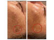 アミュレット(AMULET)の雰囲気（【皮膚理論に基づいたスキンケア】お肌のマイナス要因デトックス）