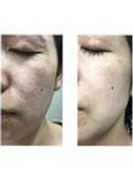 ハイナ 恵比寿店(Hi-Na)/Policy正規取扱店/たるみ/恵比寿