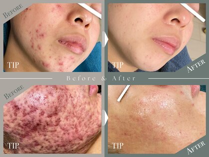 キー(kii)の写真