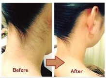 ニニ(Nini)/うなじ美人♪