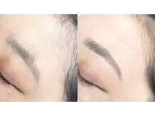 グランデ(Grande)/県内唯一受けれる眉周り脱毛