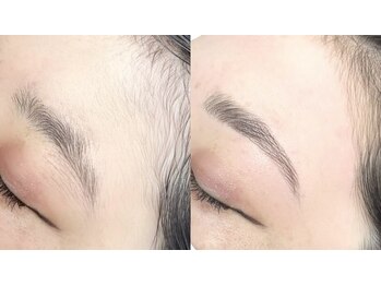 グランデ(Grande)/県内唯一受けれる眉周り脱毛