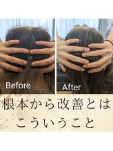 スウ(suu.)/Before-After【30代】1回