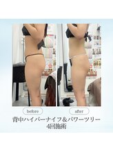 エスプレッソ(espresso,)/【短期痩せ】ならパワーツリー