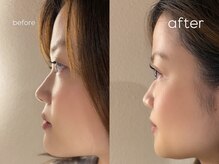 イオレ(IOLE)の雰囲気（L3リフトで、ケアしながらハリ・ツヤのある目元へ*）