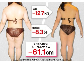 セントラヴィ 本厚木店/Before After【20代女性(2)】