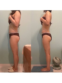 トラスト(TRUST)/足全体4大スリムショック体験