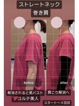 パワーパステル/来店時から４回目after 美姿勢へ