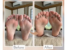 フウカ(Fuka)の雰囲気（冷えや血行不良やより紫色になっていた足がピンク色に◎）