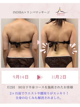 スーペリオル(Superior)/2ヶ月弱で驚きの変化!