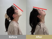 せなかのはね 難波心斎橋店/30代 女性 猫背 睡眠の質