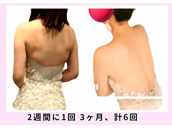 ユルポ(YuREPOS)/ブライダル前にも整えられる☆