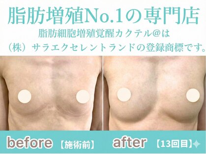 サラエクセレント 銀座の写真