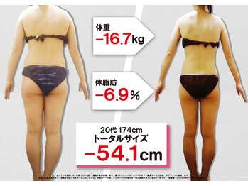 セントラヴィ 本厚木店/Before After【20代女性(3)】