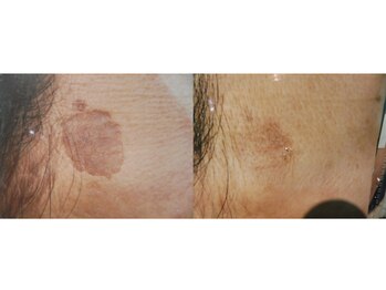 エムズ(M’s)/だいぶきれいになりました。