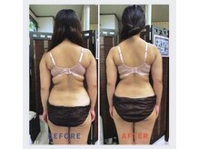 シエスタ(SIESTA)/脂肪の癒着をとり本来の美Bodyへ