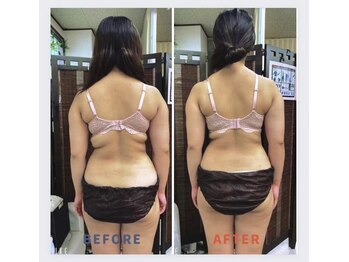 シエスタ(SIESTA)/脂肪の癒着をとり本来の美Bodyへ