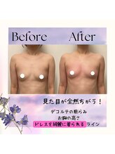 セイ(SEI)/正しい位置に戻す