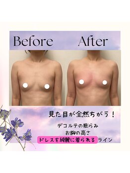 セイ(SEI)/正しい位置に戻す